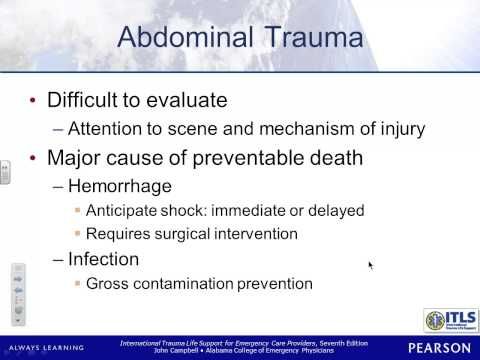 Video guide by sucollege: TRAUMA Chapter 13  #trauma