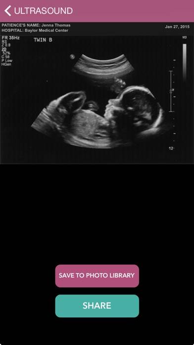 Baby Ultrasound 2015 iOS