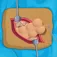 Appendix Surgery App icon