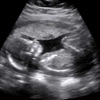 Baby Ultrasound 2015 iOS icon
