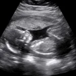 Baby Ultrasound 2015 App Icon