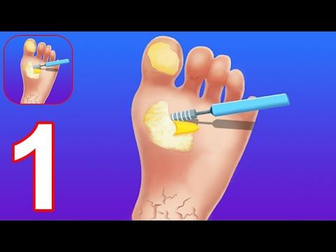 Video guide by Pryszard Android iOS Gameplays: Foot Clinic Part 1 #footclinic