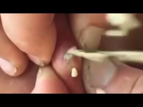 Video guide by COMPILATION POPPING VIDEOS: Popping Part 2. #popping
