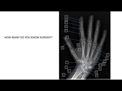 Video guide by RadTips: X-Ray™ Level 1 #xray