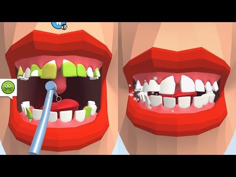 Video guide by Good Games: Dentist Bling Level 15 #dentistbling