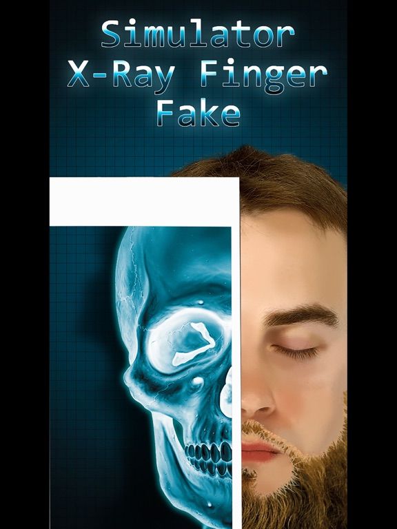 Simulator X-Ray Bone Fake game screenshot